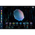 Mosaiq (licence) UVI
