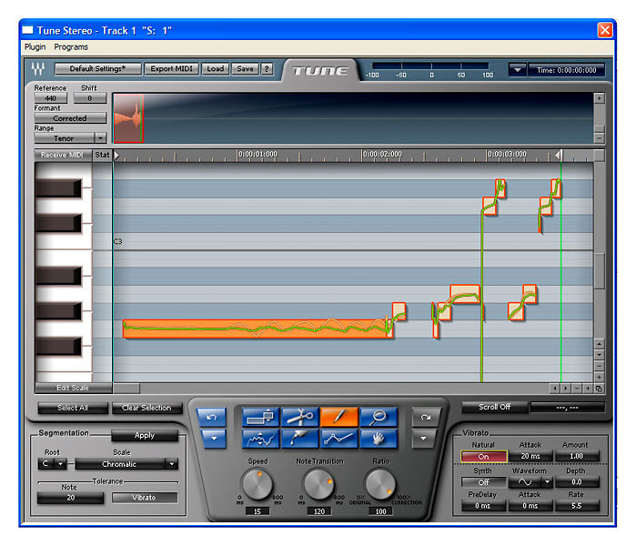 Waves VOCAL BUNDLE Native